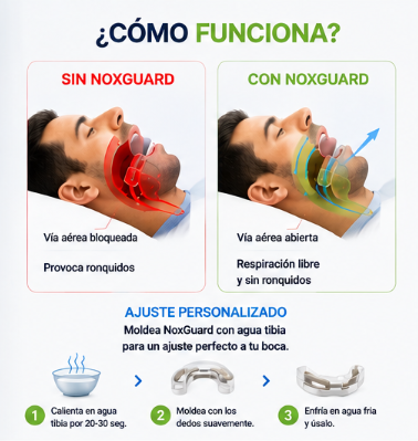 NoxGuard 👃